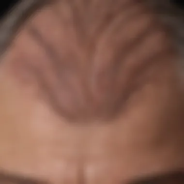 A close-up view of a scalp showing fine wrinkles and texture