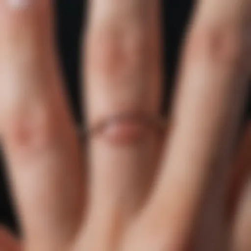 Close-up of a hangnail on a finger depicting discomfort.