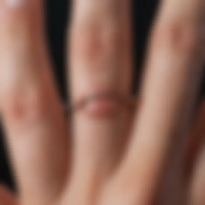 Close-up of a hangnail on a finger depicting discomfort.