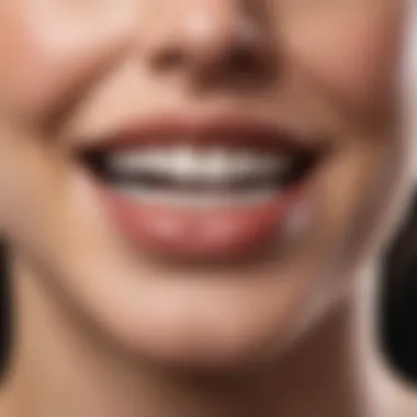 Professional teeth whitening treatment