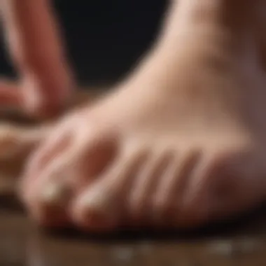 Visual representation of fungal infection affecting toenails