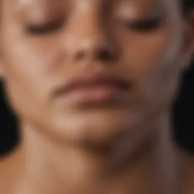 Illustration of skin types affected by tinea versicolor