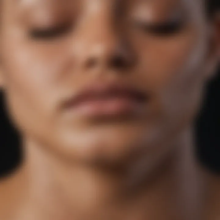 Illustration of skin types affected by tinea versicolor