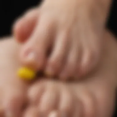 Illustration of a foot with symptoms of nail discoloration